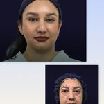 کلینیک زیبایی الماس کاملا اقساطی
