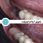 کلینیک دندانپزشکی دیجیتال نگین شیراز