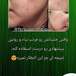 پاکسازی و فیشیال درمانی فروزان