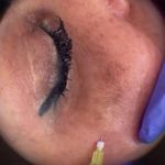 دکتر زیبایی بوتاکس دکتر شیرین امیر حسنی