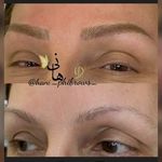 میکروبلیدینگ و آرایش دائم هانیه بحرینی