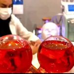 انجام کلیه کارهای زیبایی ودرمانی پوست ومو به صورت غیر تهلجمی