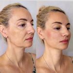 کلینیک پوست و زیبایی ژیلاوَش