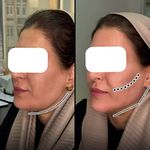 کلینیک زیبایی و لیزر نگین شرق