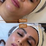 فیشال تخصصی پوست هلیا