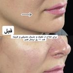 مطب زیبایی دکتر نلسا