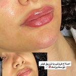 مرکز پوست و مو  فریحا