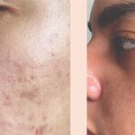 کلینیک پاکسازی پوست و فیشال والربیوتی