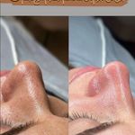 کلینیک فیشال و ماساژ سارن اسکین سارا