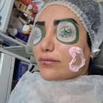 خدمات فیشال و ماساژ تخصصی صورت طراوت