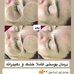 پاکسازی پوست محمودآباد - ریحانه