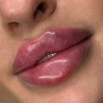 کلینیک زیبایی شایلی