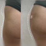 کلینیک لیزر  کندلاوزیبایی پوست ومو آیشیل