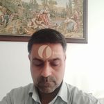 کاشت مو تخصصی مبینا دهقان