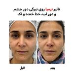 کلینیک زیبایی پوست و مو آتریسا
