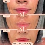 مرکز پزشکی و زیبایی میروژ سنتر