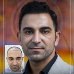 کلینیک پوست مو و زیبایی نوین ایرانا