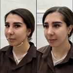 مطب زیبایی دکتر شایان صدری نسب