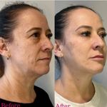 کلینیک پوست و زیبایی ژیلاوَش