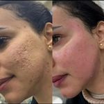 مرکز پوست و لیزر  سایناشور آمریکا دلدار