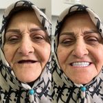 دندانسازی محلات (فتح المبین )