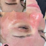 کلینیک فیشال و ماساژ سارن اسکین سارا