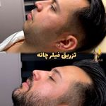 کلینیک زیبایی و مرکز لیزر هانیسا