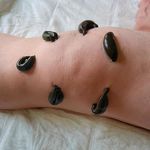 کلینیک طب سوزنی سنتی سینا