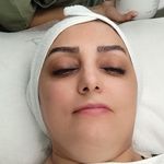 خدمات پاکسازی پوست غزال
