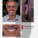 کلینیک تخصصی تهران ایمپلنت