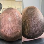 کلینیک هانیل | فیلر و بوتاکس شرق
