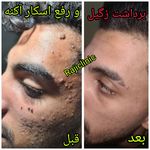 کلینیک لیزر زیبایی و درمانی دکتر راجی‌فر