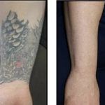 مطب پوست، مو و زیبایی و لیزر شبیرا