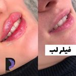 کلینیک زیبایی پوست و مو و لیزر پامچال