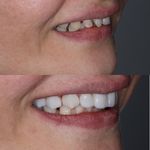 دنداپزشکی دکتر یاشار معزز
