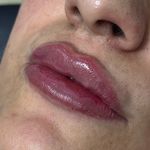 کلینیک زیبایی ولیزر دریا(کندلا آمریکایی)