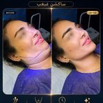 کلینیک تخصصی زیبایی و لیزر موی ابریشم