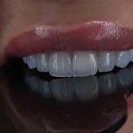 کلینیک طراحی لبخند مایا