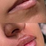 کلینیک تخصصی لیزر پوست مو زیبایی آی‌تا