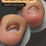 پودولوژی هیوا