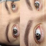 مرکز میکروبلیدینگ شیدینگ ریموو اسکالپ