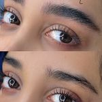 میکروبلیدینگ و شیدینگ مینا حسینی