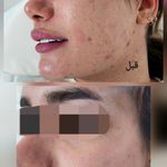 فیشیال و خدمات پاکسازی پوست الهام اورا