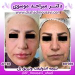 دکترمیراحدموسوی