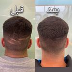 کلینیک پوست، مو، لیزر آنست