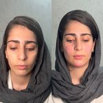 کلینیک نچرال بیوتی