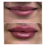 مطب زیبایی دکتر سیده زهرا حسینی