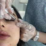 کلینیک لیزر  کندلاوزیبایی پوست ومو آیشیل