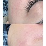 خدمات پوست و فیشال ریحانه زمانی