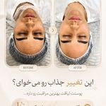 کلینیک فیشیال پوست صفا قم